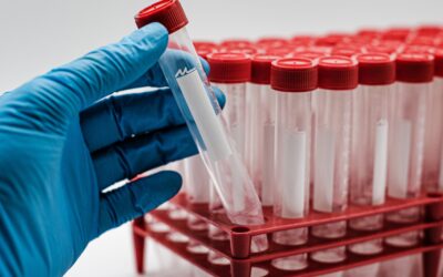 The Uses of Centrifuge Tubes: Things to Consider When Purchasing Centrifuge Tubes