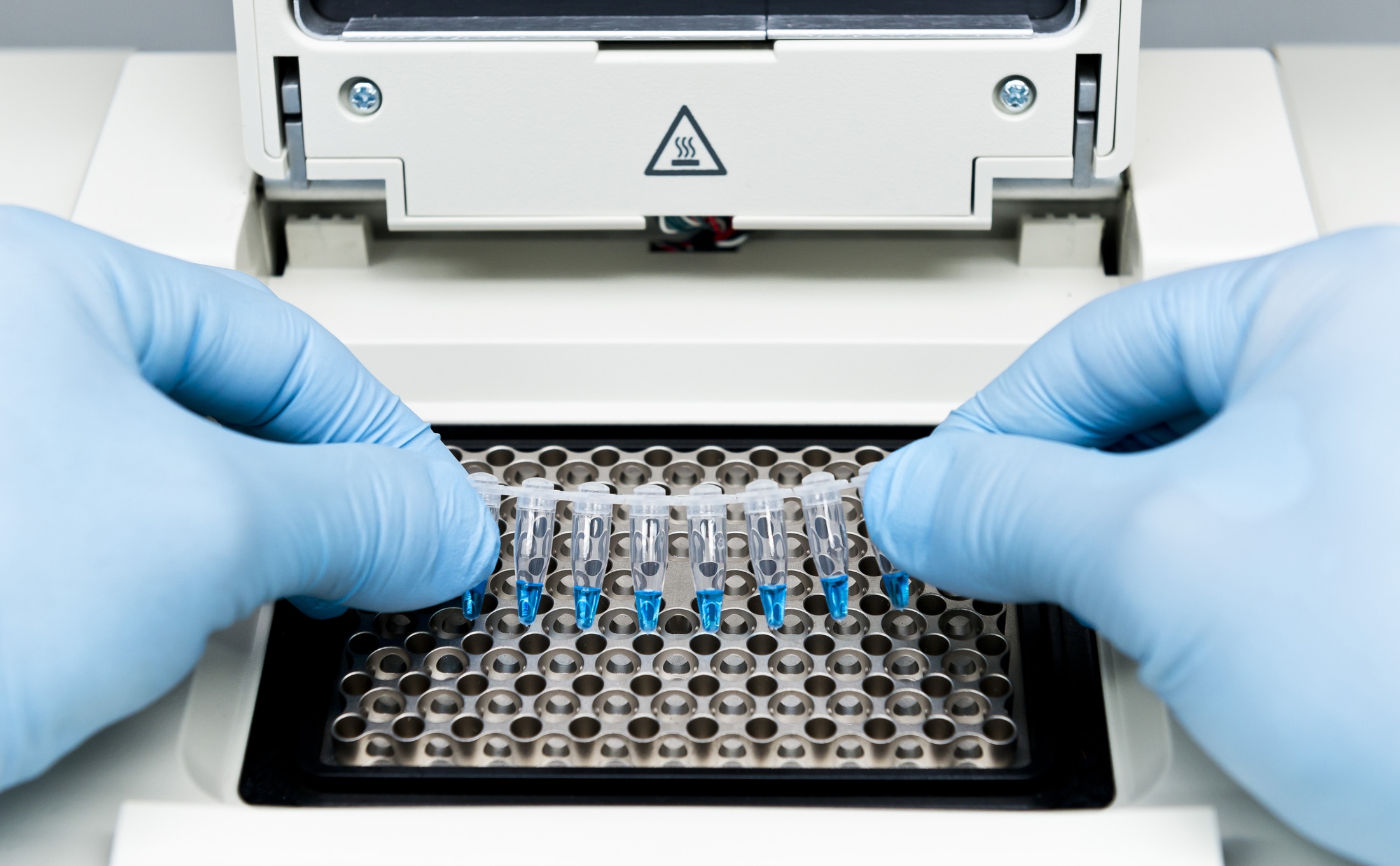 The Impact of Regular Calibration on PCR Machine Performance